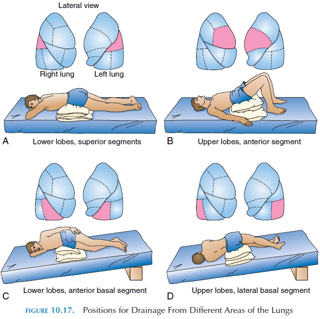 Tapotement Massage for Lungs