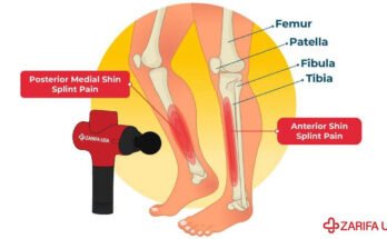 Can I Use a Massage Gun on Shin Splints?
