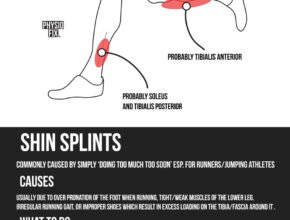 Is It Good to Massage Shin Splints?