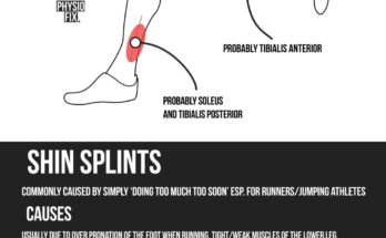 Is It Good to Massage Shin Splints?