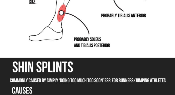 Is It Good to Massage Shin Splints?