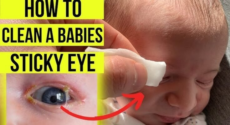 How Do I Clean an Eye Massager?