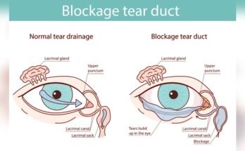 How Long Does a Typical Eye Massager Last?