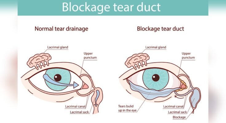 How Long Does a Typical Eye Massager Last?