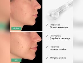 Can Gua Sha Tools Help With Jawline Definition