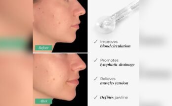 Can Gua Sha Tools Help With Jawline Definition
