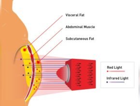 Can Infrared Heat Lamps Help With Weight Loss