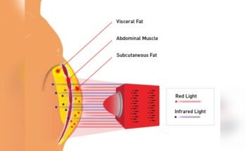 Can Infrared Heat Lamps Help With Weight Loss
