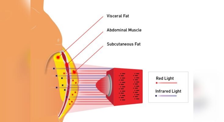 Can Infrared Heat Lamps Help With Weight Loss
