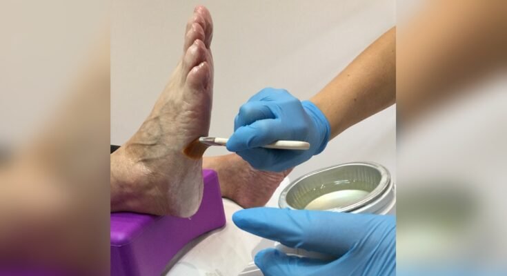 Can Paraffin Wax Bath Machines Help With Cracked Heels