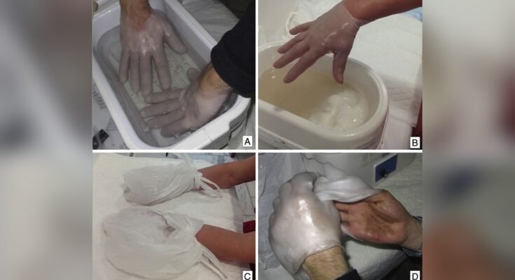 Can Paraffin Wax Bath Machines Help With Eczema