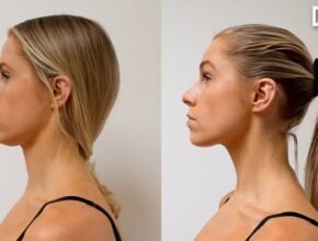 Does Gua Sha Really Reduce Face Puffiness