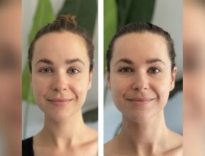 How Long Does It Take to See Results from Gua Sha