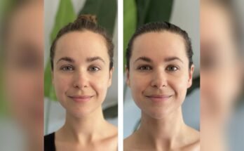 How Long Does It Take to See Results from Gua Sha