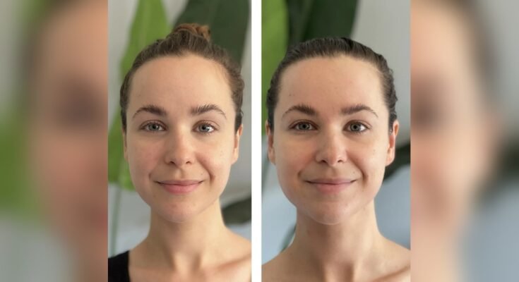 How Long Does It Take to See Results from Gua Sha