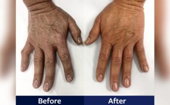 How Long Should a Paraffin Wax Treatment Last