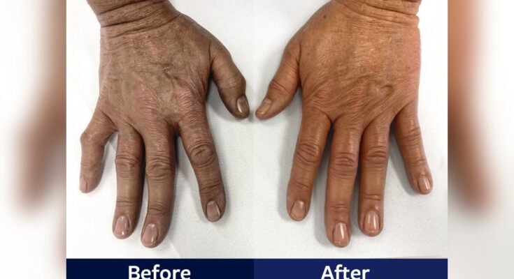 How Long Should a Paraffin Wax Treatment Last