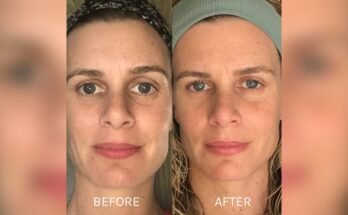 How Often Should You Use a Gua Sha Tool