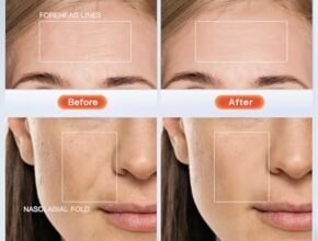 Best Red Light Therapy Face Mask