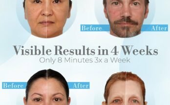 Red Light Therapy Face Mask